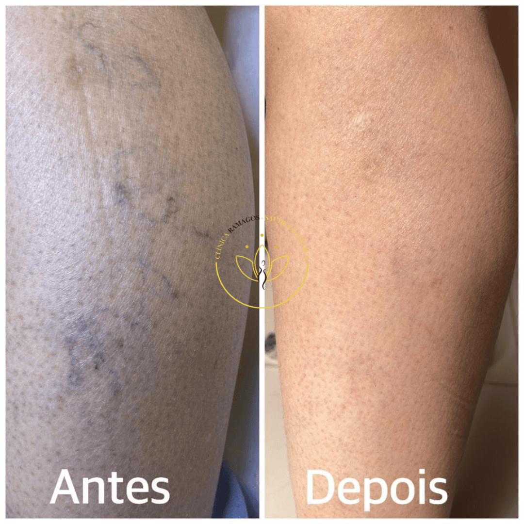 Design sem nome (10)