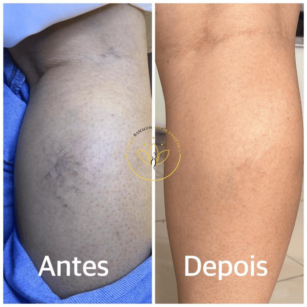 Design sem nome (11)