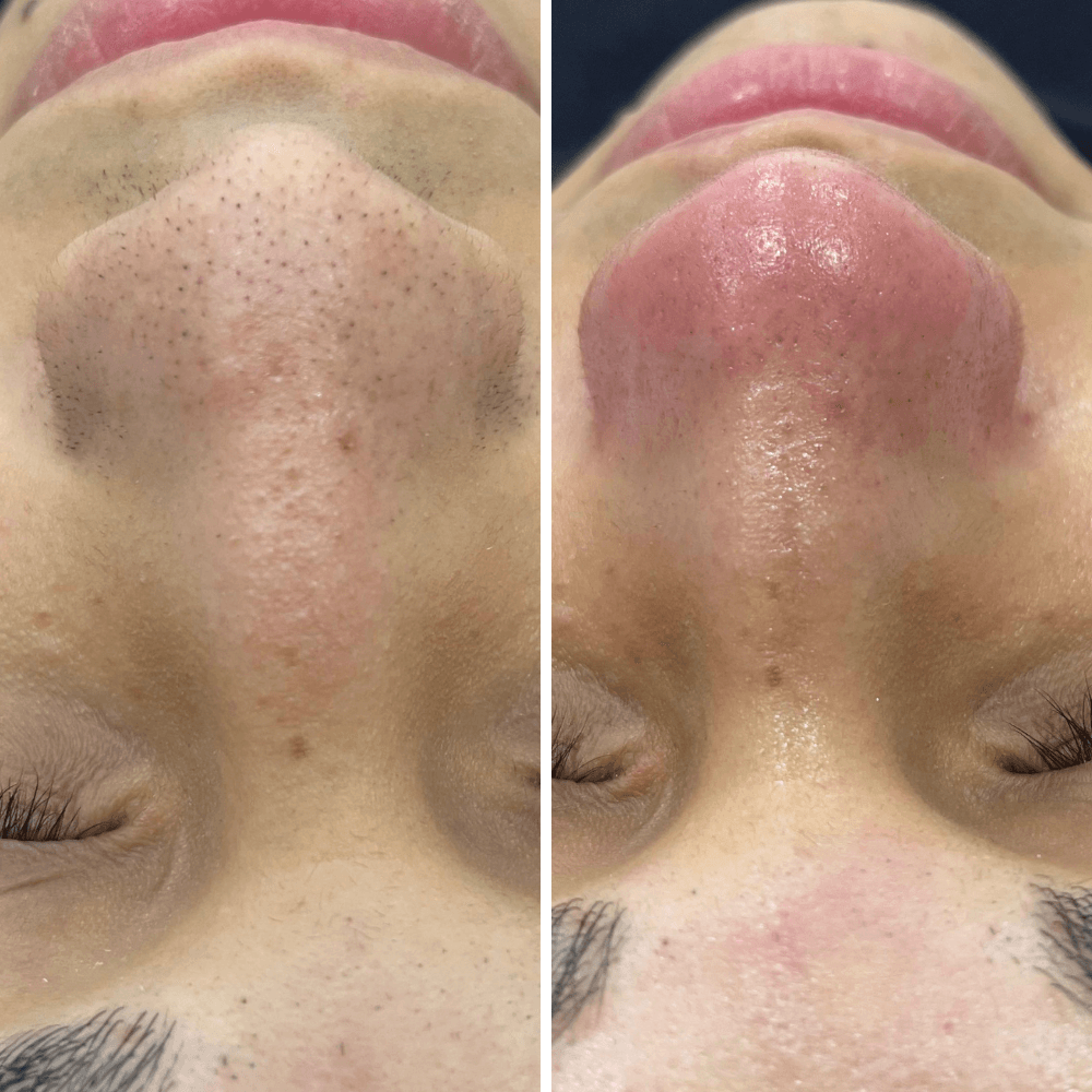 colocar na parte de limpeza de pele site