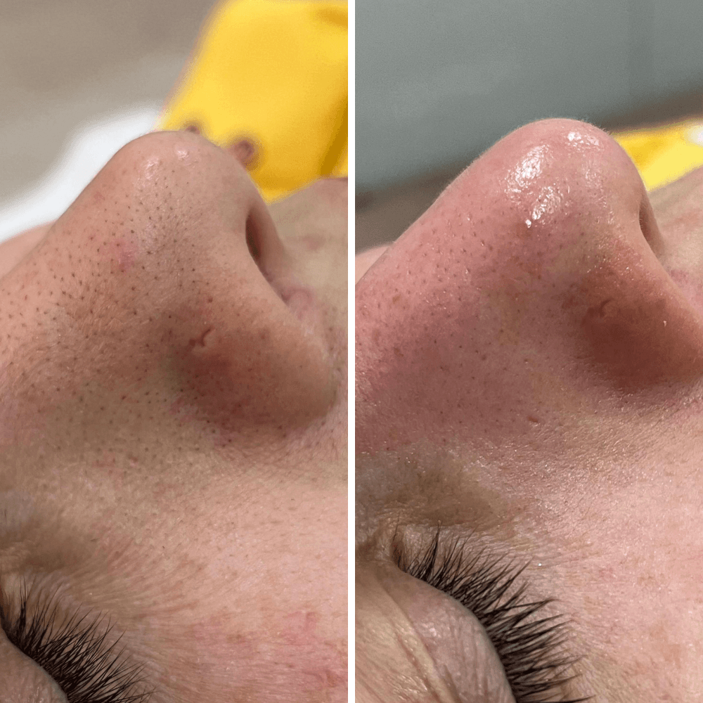 limpeza de pele para colocar no site