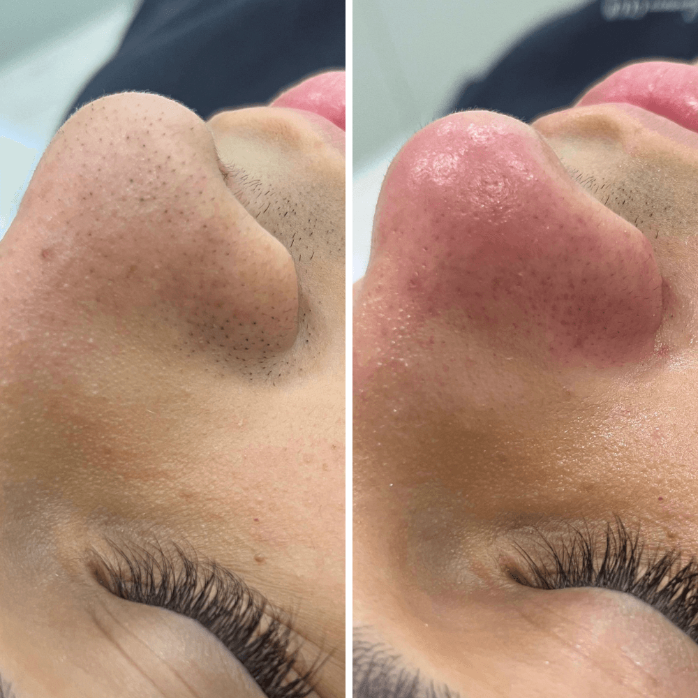 limpeza de pele para colocar no site (1)